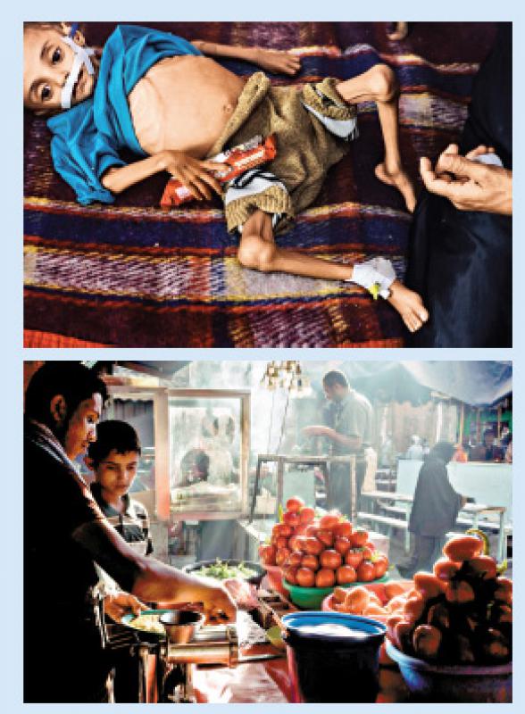 也門饑荒相 奪特寫攝影獎