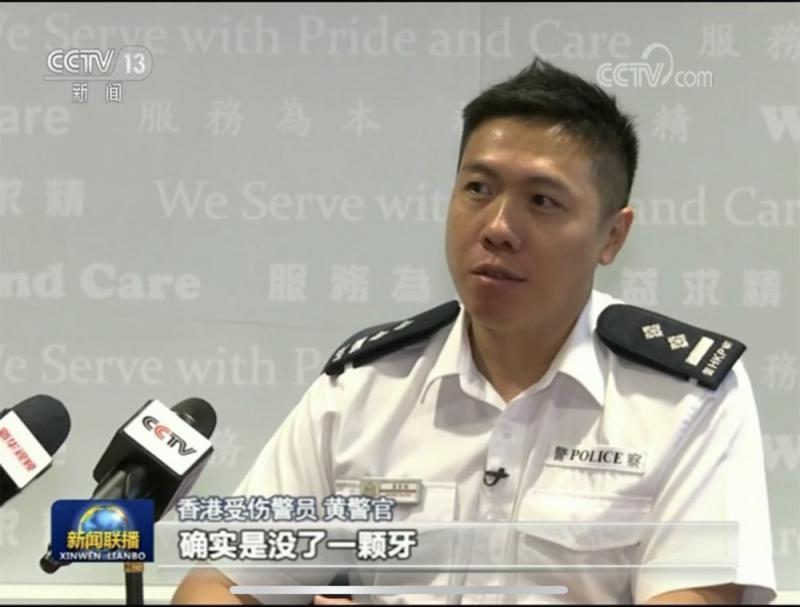 香港警察：維護法紀，受點傷也值得！
