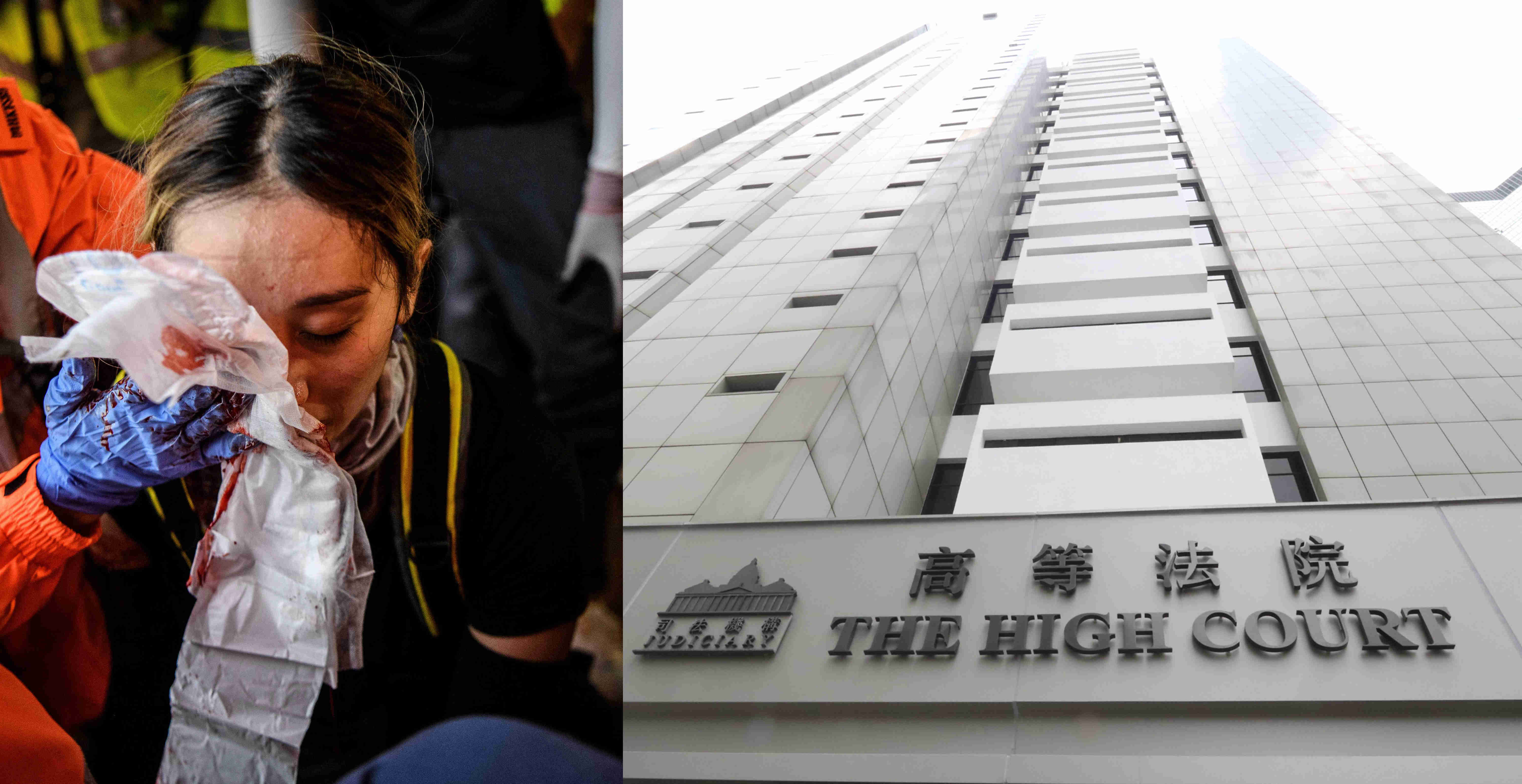 香港高院審理「爆眼女」覆核案 警方強調合法取得手令