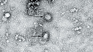 世卫组织：泰国发现1例新型冠状病毒病例