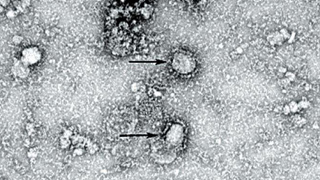官方：新型冠状病毒感染的肺炎纳入法定传染病管理
