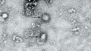 新型冠状病毒感染的肺炎英文简称为“NCP”