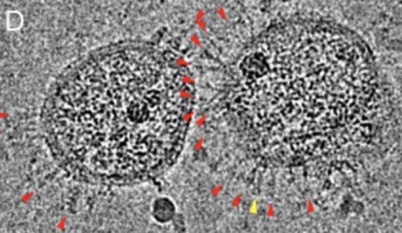 新冠病毒露真容 捕捉入侵細胞過程