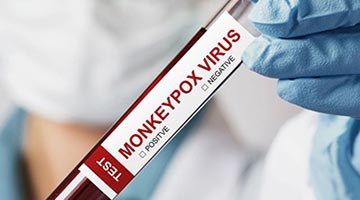 重慶猴痘病例病毒與德國病毒高度同源 系大陸首例輸入性猴痘病例