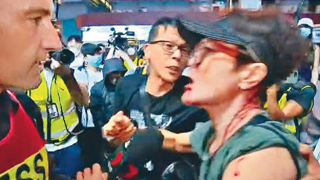 “暴徒才是香港的敌人” 澳记者揭真相遭死亡威胁