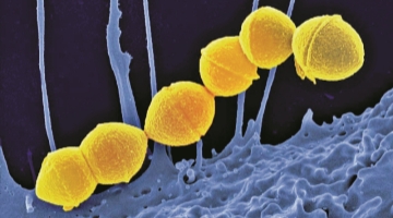 ﻿日本“食人菌”感染者近千 创历史新高